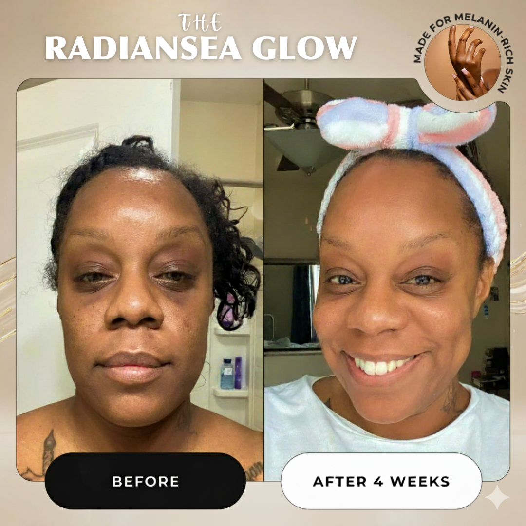 Advanced Dark Spot Correcting Serum