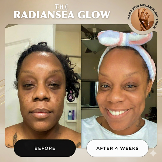 Advanced Dark Spot Correcting Serum