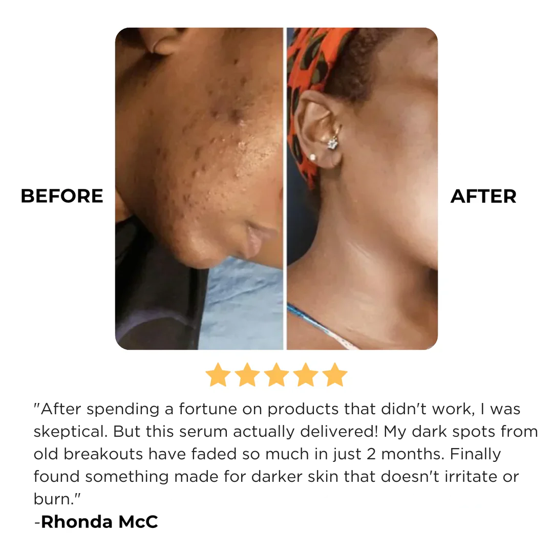 Advanced Dark Spot Correcting Serum