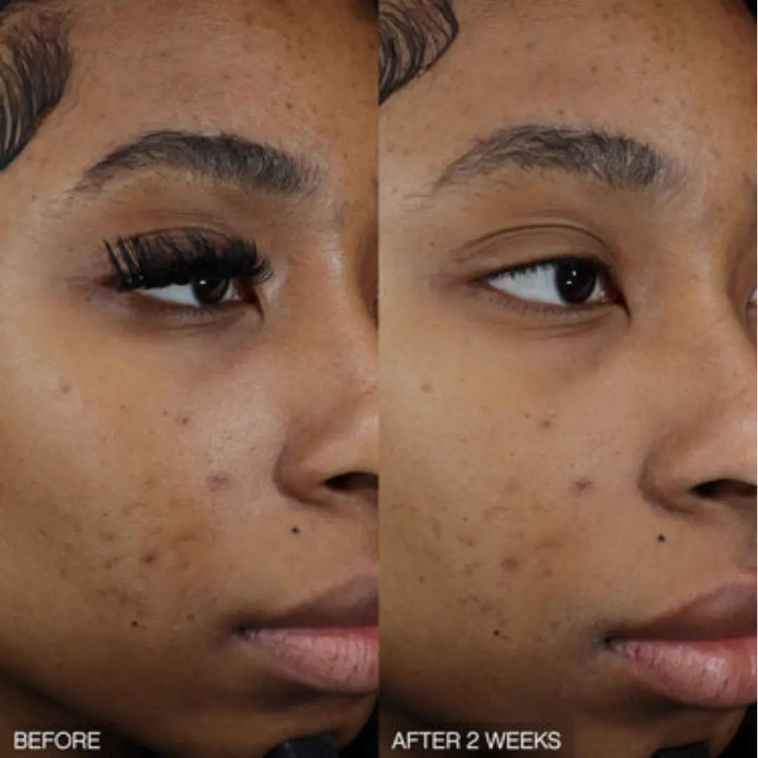 Advanced Dark Spot Correcting Serum
