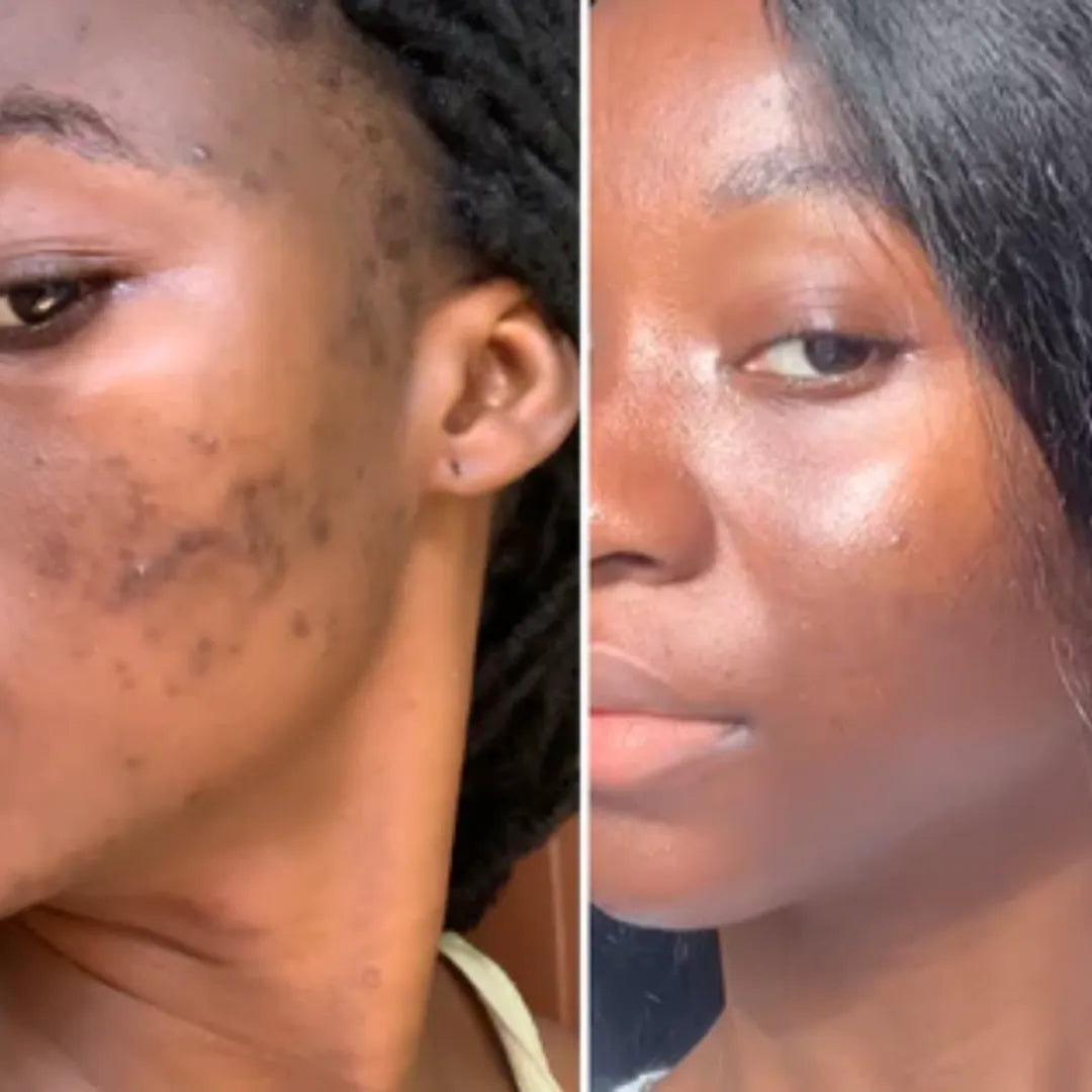 Advanced Dark Spot Correcting Serum