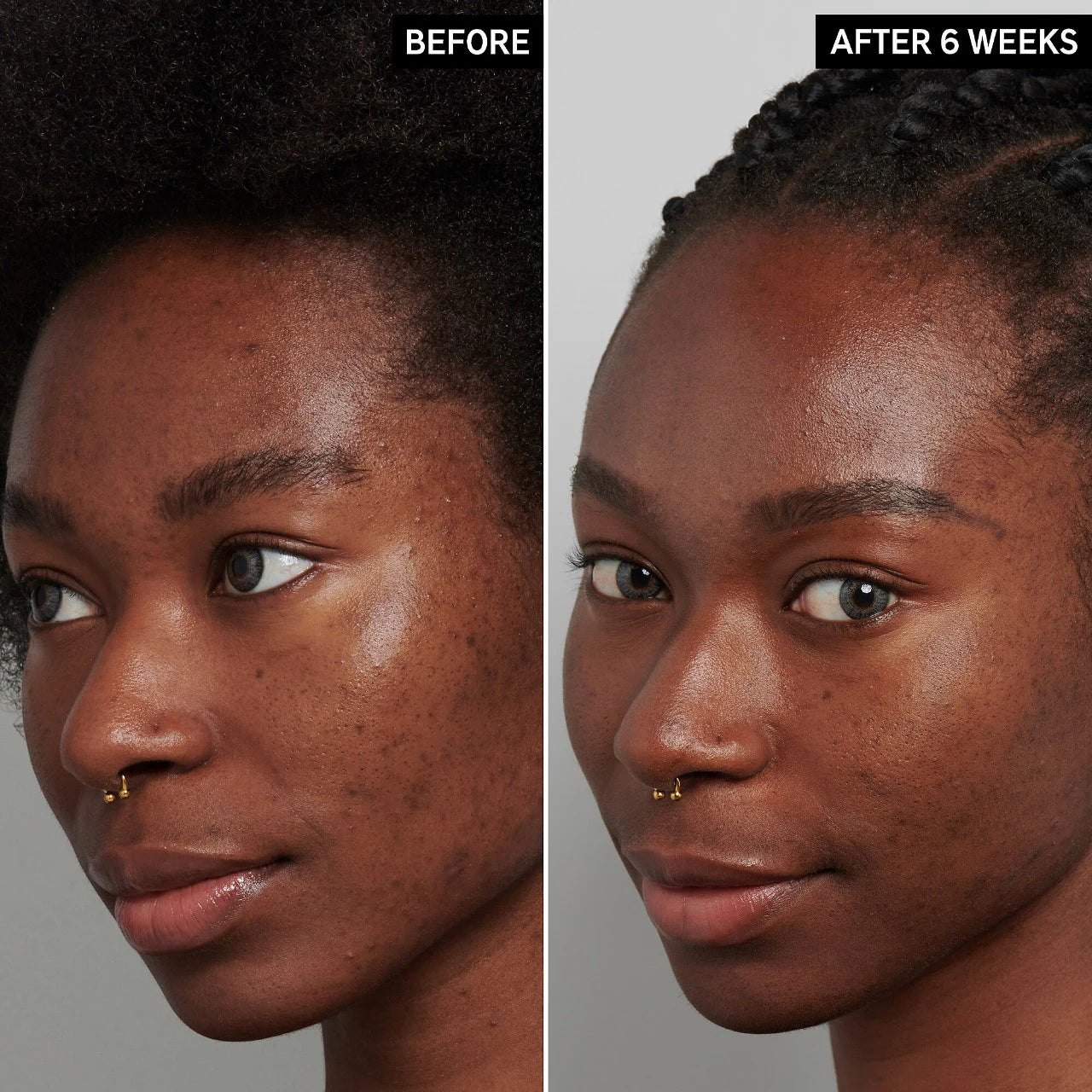 Advanced Dark Spot Correcting Serum