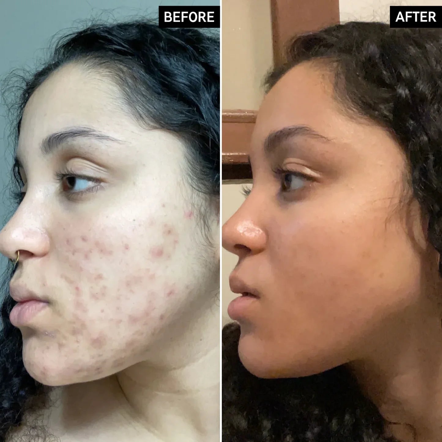 Advanced Dark Spot Correcting Serum
